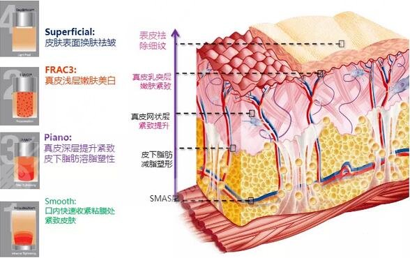 歐洲之星Fotona4D和熱瑪吉哪個(gè)果好