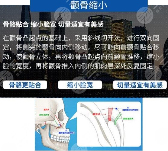 上海華美和首爾麗格哪家好