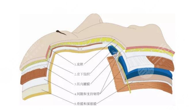 歐洲之星fotona4d有哪些果