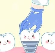 珠海人民醫(yī)院種植牙多少錢