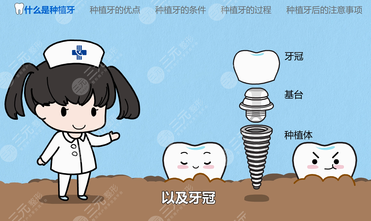 上海种植牙哪个医院好