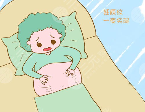 歐洲之星去妊娠紋果