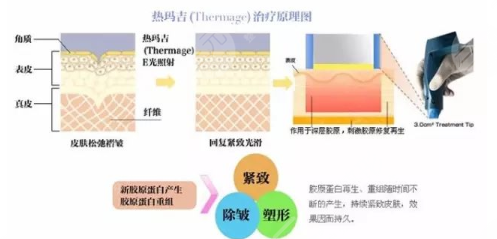 熱瑪吉多少錢一次