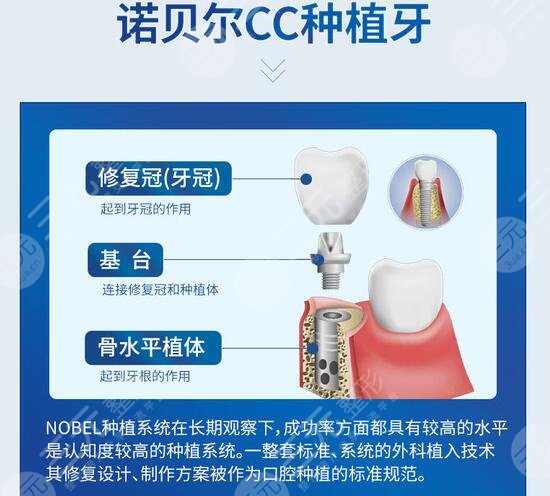 深圳种植牙好的牙科医院是哪家