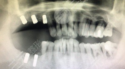 成都恒泰牙科怎么樣