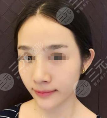 上海伊尔美医疗美容医院怎么样