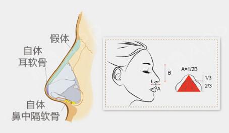 惠州隆鼻三甲(公立)医院排名榜