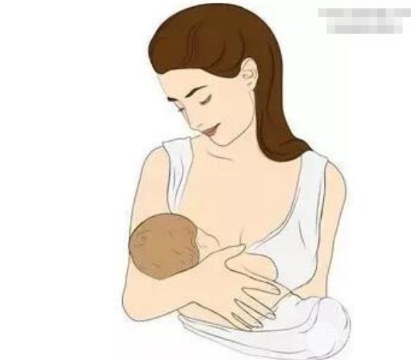 做過假體隆胸可以哺乳嗎