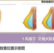 臺(tái)州乳房整形三甲公立醫(yī)院前五強(qiáng)排名公布