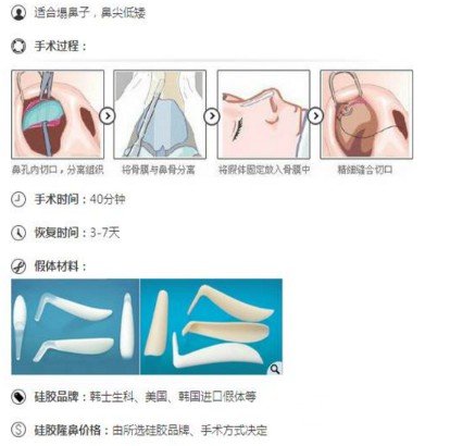 單純硅膠隆鼻果圖