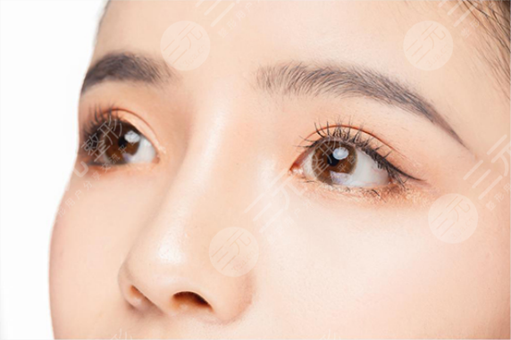 北京微创双眼皮手术体验分享