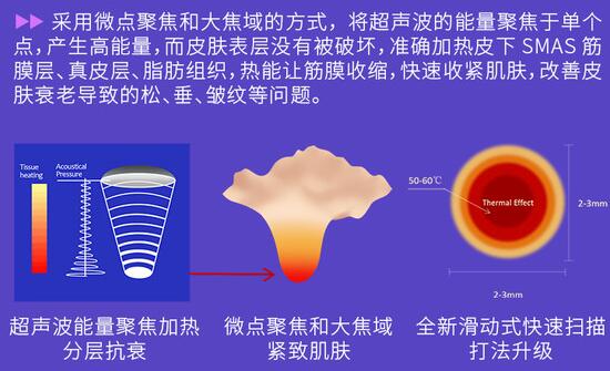 半島超聲泡果怎么樣