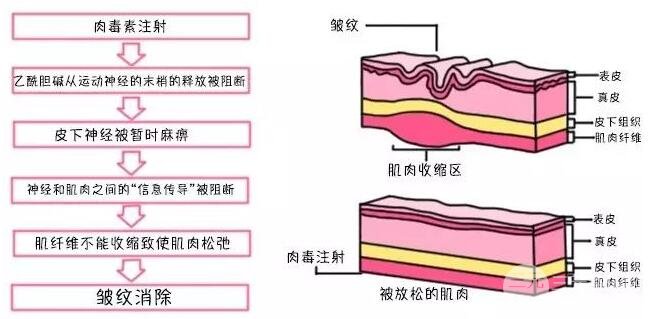 這幾個(gè)去除魚尾紋的方法