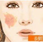 溫州去胎記哪家醫(yī)院好