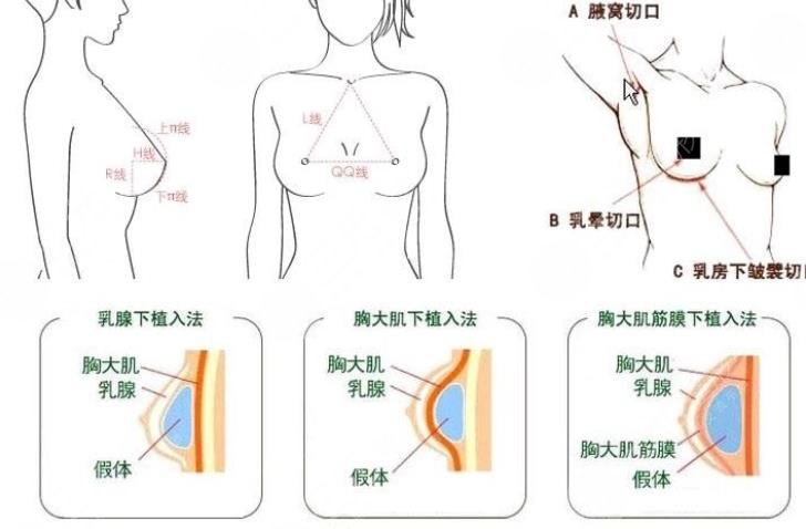 溫州隆胸好的醫(yī)院有哪些