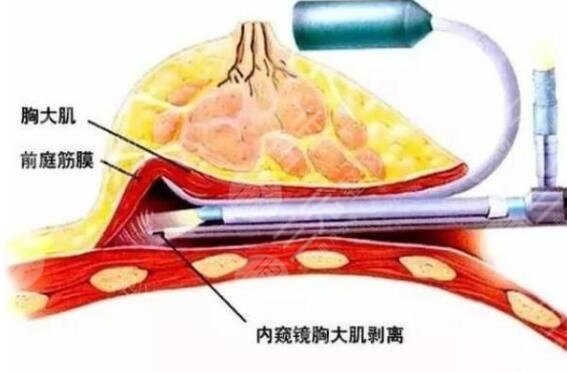 鄧正軍手術(shù)案例