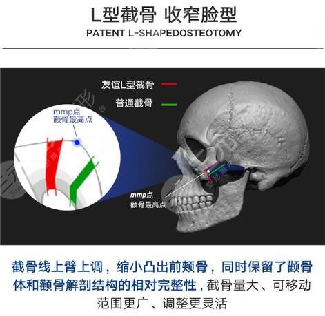 全國整形醫(yī)院排行榜