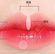 福州嘴唇部整形哪家醫(yī)院好