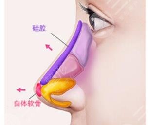 四川华西医院美容科价目表更新啦