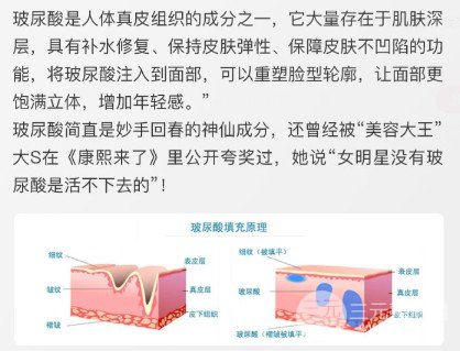 玻尿酸隆鼻果好不好