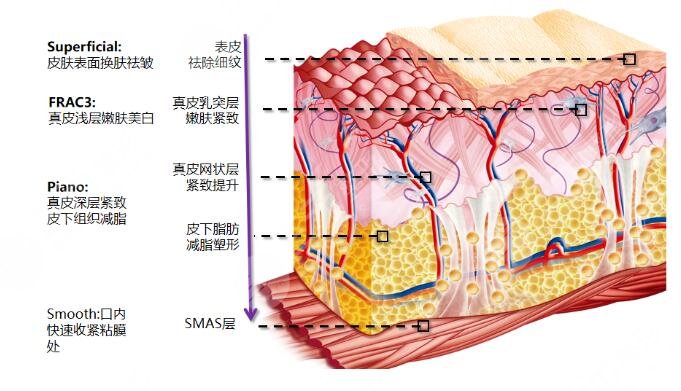 歐洲之星fotona4d有哪些果