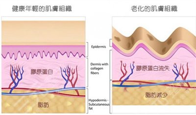 除皺手術(shù)多種方法優(yōu)缺點(diǎn)價(jià)格介紹