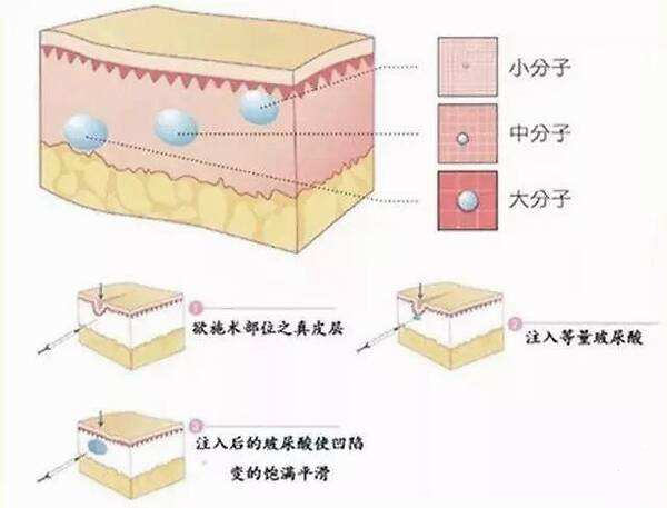 告别苦瓜脸只需这个方法