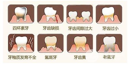 烤瓷牙多久換一次