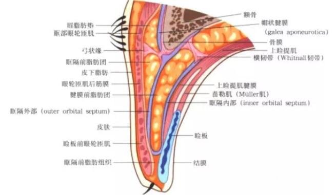 埋線做的雙眼皮兩個(gè)月就沒了