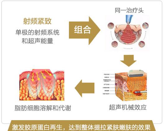 btl愛(ài)麗絲超頻刀靠譜嗎