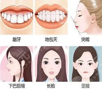香港大学深圳医院牙齿正畸注意事项有哪些