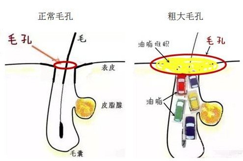 男生皮膚粗糙如何改善