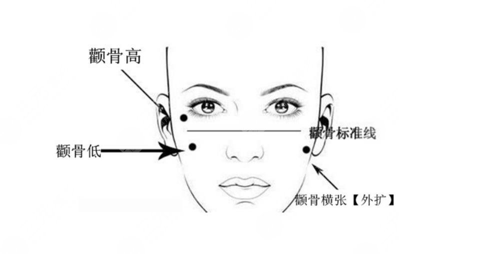 深圳下頜角醫(yī)院哪家好