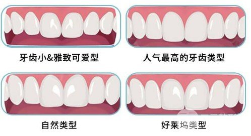 說了牙齒貼面的優(yōu)點(diǎn)和缺點(diǎn)