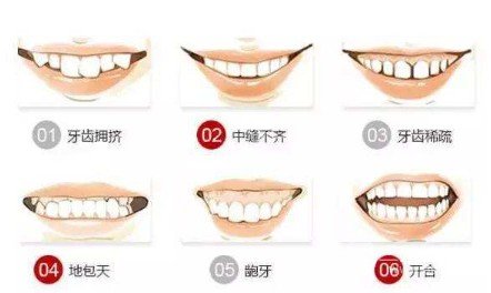 淮北哪里矯正牙齒好