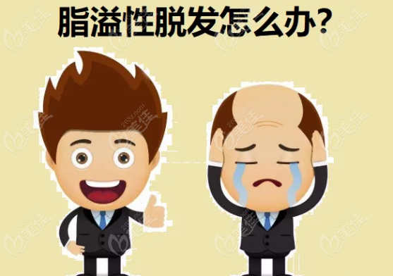 本文教你脂溢性脫發(fā)如何自救