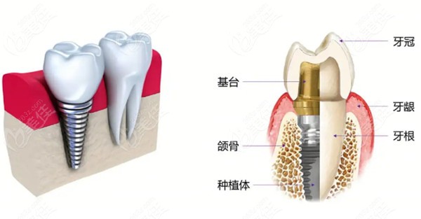 甘肅慶陽口腔醫(yī)院收費價目表