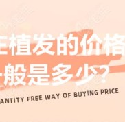 石家莊植發(fā)的價(jià)格一般是多少