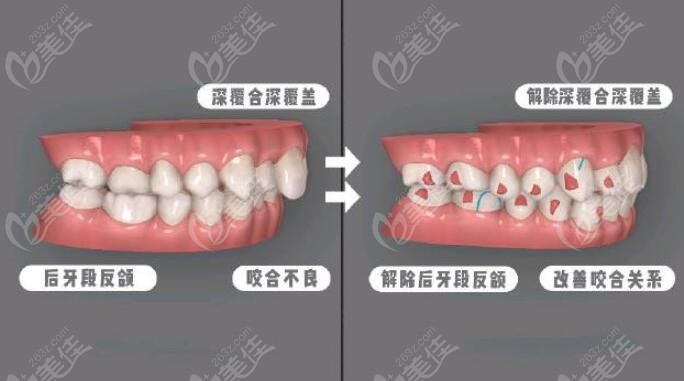 松桃鵬博口腔價格怎么樣