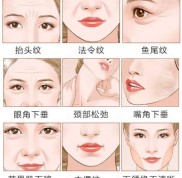 去云南做拉皮提升手術(shù)好的昆明博美整形
