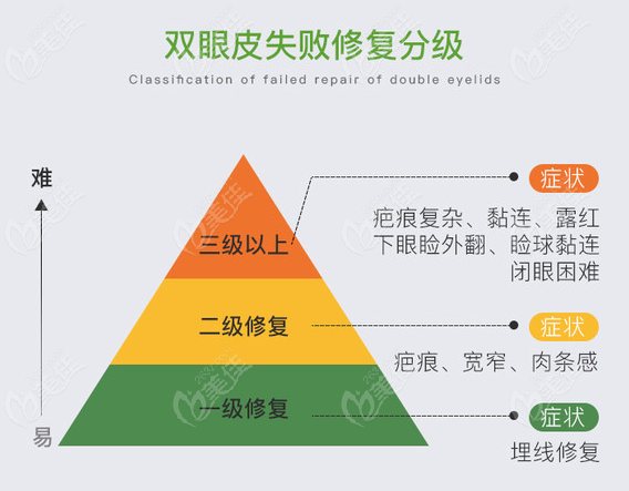 2022國內(nèi)內(nèi)眼角修復(fù)好的醫(yī)生排名