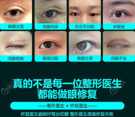 北京双眼皮修复比较好的医生中白永辉和郭广科谁的眼修复技术更厉害