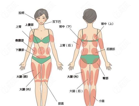 全身吸脂價格一覽表