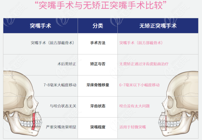 这一份韩国凸嘴手术医院排名约等于是韩国正颌手术医院排名哦