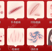 昆明祛疤痕好的醫(yī)院排名榜