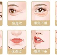 武漢做拉皮手術(shù)好的醫(yī)院做一次大拉皮可不便宜