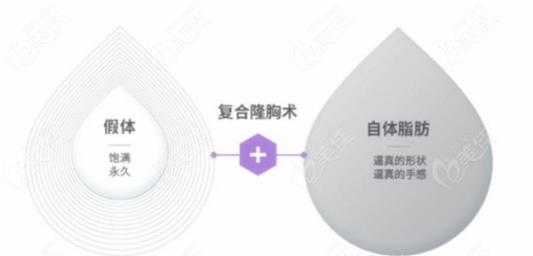 常熟哪里有做豐胸手術(shù)的