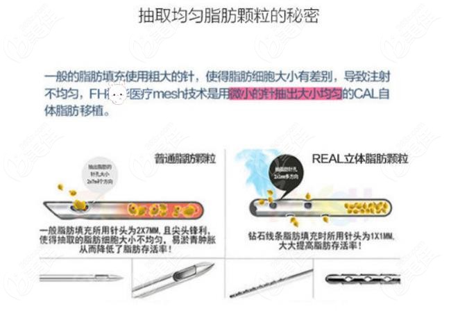 宿州自体脂肪面部填充哪家医院做的好