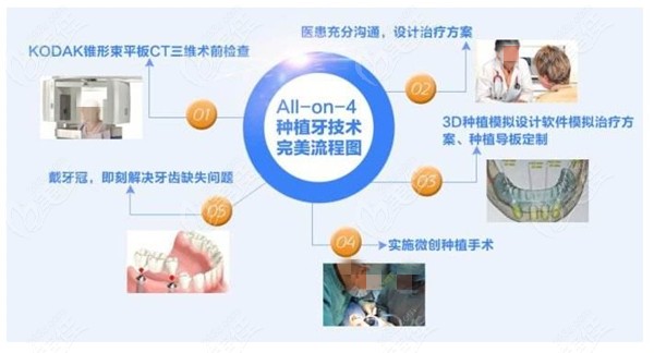 牙槽骨水平吸收可以植骨吗