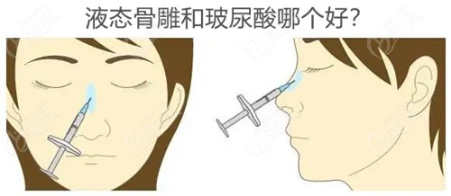 液态骨雕隆鼻和玻尿酸隆鼻的区别在于